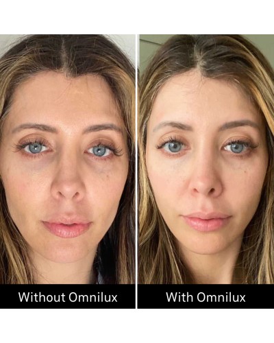 Omnilux Contour - Maschera LED Viso Rughe