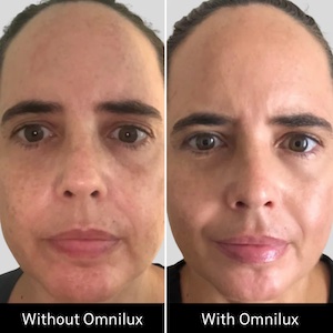 Prima e dopo